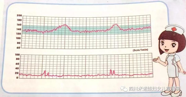 成都哪里做产前检查