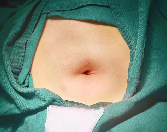 成都哪里做腹腔镜手术好