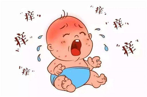 儿童麻疹有什么症状
