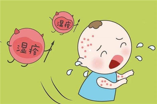 婴儿湿疹怎么治疗？婴儿湿疹治疗的误区
