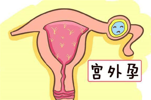 宫外孕早期症状有哪些？什么情况下容易发生宫外孕？