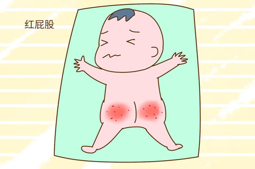 如何避免宝宝出现红屁股？这几个步骤一个都不能少！