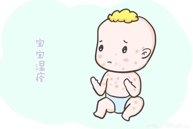 米诺娃妇女儿童医院：宝宝长湿疹了怎么办？