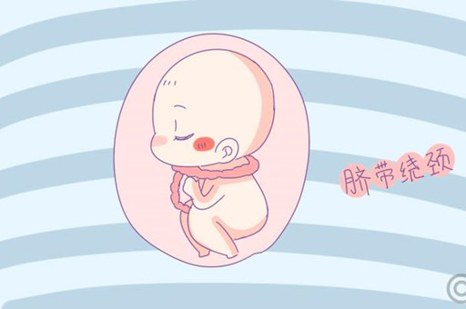脐带绕颈一周危险吗？还能顺产吗？