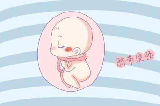 婴儿脐带绕颈怎么办？脐带绕颈还能顺产吗？