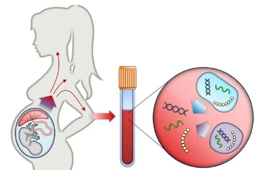 米诺娃妇女儿童医院：孕前、早孕基因筛查分别做什么？