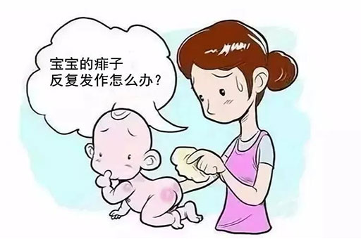 一到夏天，宝宝痱子反复发作怎么办？