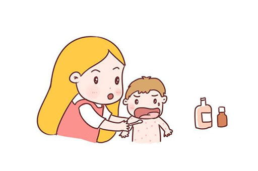宝宝痱子老是不好怎么办？