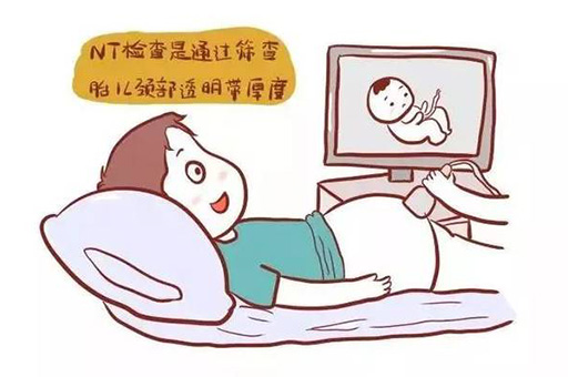 做NT检查一般要多少钱呢？